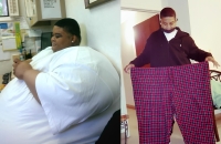 دون جراحة.. كيف خسر شاب 160 كيلو من وزنه؟