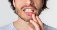 احذر.. إهمال الأسنان في رمضان يصيب بأمراض مميتة