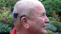 أجهزة السمع قد تقي العديد من كبار السن من الخرف - مشاع إبداعي