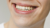 العناية الجيدة بالأسنان تقي من مشكلات الفم واللثة - مشاع إبداعي