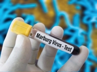 "الصحة العالمية" تتوقع انتهاء تفشي فيروس ماربورج في غينيا الاستوائية