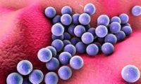 صورة ميكروسكوبية لعدوى بكتيرية - مشاع إبداعي