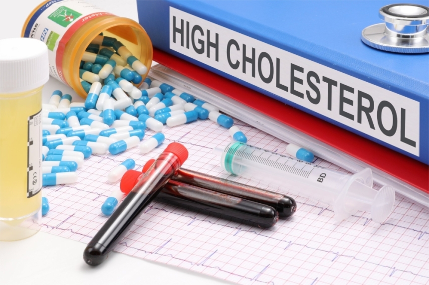 ارتفاع الكوليسترول في الدم يؤثر سلباً على الصحة - مشاع إبداعي