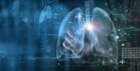 مرض يهدد الحياة..كيفية علاج متلازمة ضيق التنفس الحادة