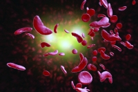 داء الكريّات المنجلية هو اضطراب خلايا الدم الحمراء الوراثي (اليوم)