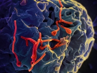 فيروس إيبولا شديد الخطورة- مشاع إبداعي