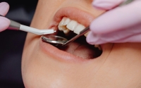 قم بزيارة طبيب أسنانك الإجراء فحوصات روتينية كل 6 أشهر - مشاع إبداعي