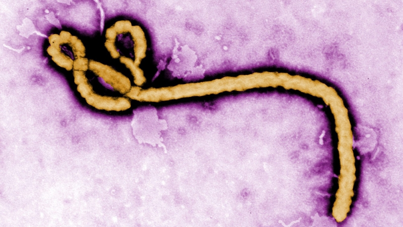  منظمة الصحة ترسل فريقاً طبياً لمالي بعد تسجيل أول حالة إصابة بالإيبولا