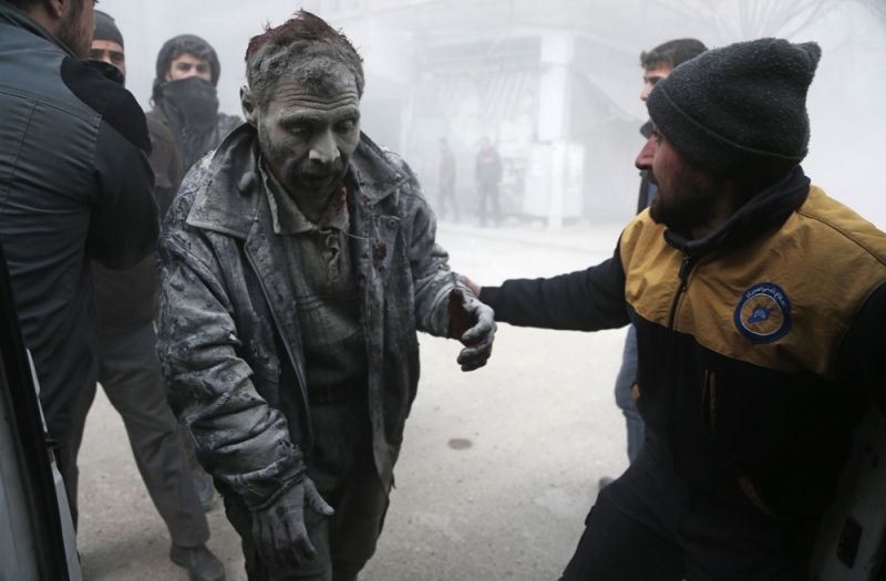 سوري مصاب بعد غارة لطيران الأسد على عربين في غوطة دمشق (أ ف ب)