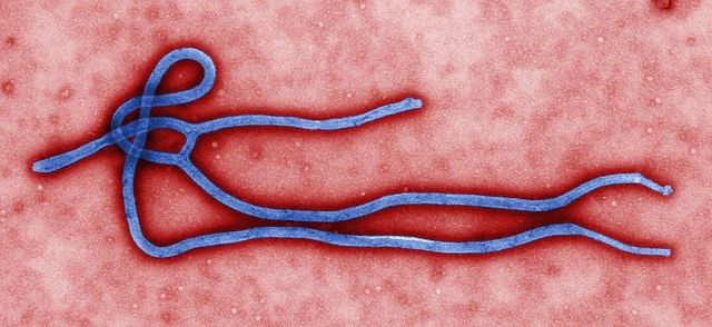 وفاة المريض المشتبه بإصابته بفيروس ايبولا صباح الاربعاء بجدة