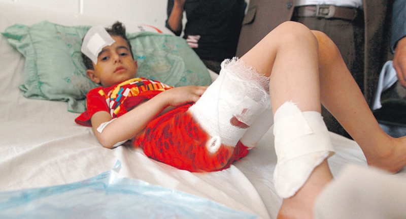 طفل أُصيب جراء العمليات الانتحارية التي شهدتها اليمن
