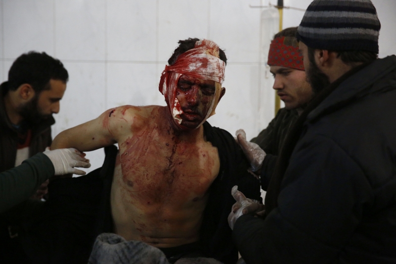 سوري مصاب نتيجة قصف قوات النظام على الغوطة