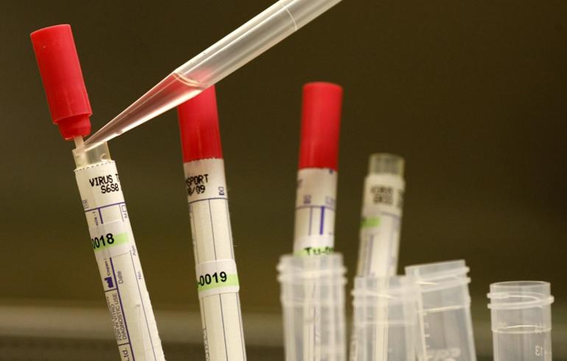علماء أمريكيون يطورون لقاحًا مضادًا لفيروس ايبولا