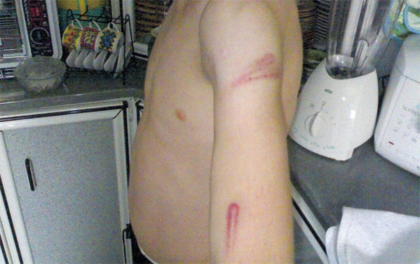 طفل تعرض للضرب من قبل أبويه