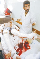 مواطن عراقي احد ضحايا التفجير في المستشفى