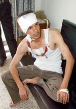 جريح عراقي يتلقى العلاج في احد مستشفيات بغداد