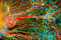 تشكل الخلايا الجذعية الجنينية أملا لعلاج أمراض مستعصية	