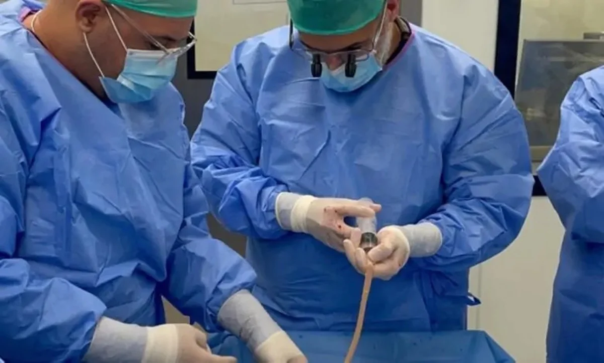 Kuwait performs Gulf’s first arterial bypass using bovine biograft