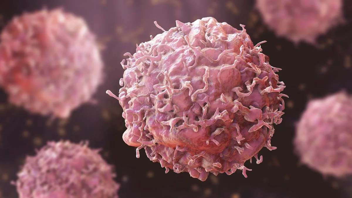 Ultrasound technology opens door to surgery-free cancer treatments