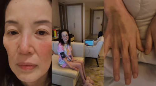 Kris Aquino, may lupus flare fever: 'I wanted you to see the pain'-Balita