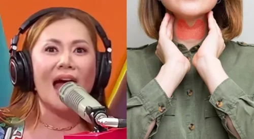 ALAMIN: Bakit sinabing 'friendliest' ang dumaleng cancer kay DJ Nicole Hyala?-Balita