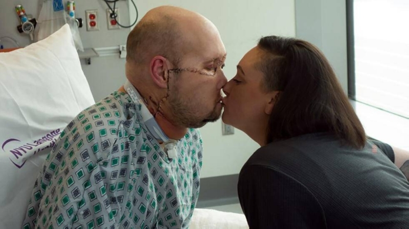 Aaron James kisses his wife in New York, where his left eye was transplanted/AFP.