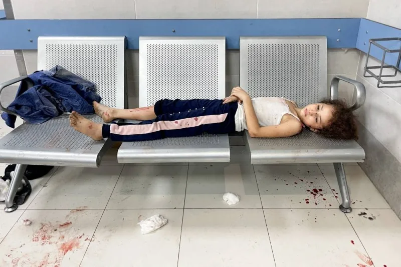  A Palestinian child, who was wounded in an Israeli strike, lies at Shifa hospital in Gaza City, on Monday. REUTERS
