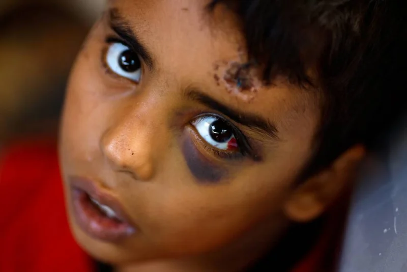 A Palestinian boy, one of the few survivors of Allamdani family, who fled to southern Gaza Strip to avoid the constant onslaught of Israeli airstrikes in Gaza City and settled in a shelter which was later hit by Israeli jets that killed 13 of his relatives, looks on, in Khan Younis in the southern Gaza Strip, on Monday. REUTERS