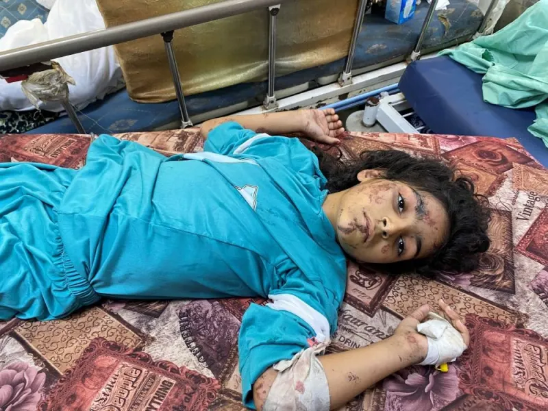 A girl wounded in Israeli strikes rests at Al Shifa hospital in Gaza City, Wednesday. REUTERS