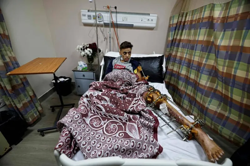 Palestinian boy Youssef, 13, receives medical care at Nasser Institute hospital in Cairo, on Sunday, after he was evacuated to Egypt following his injuries sustained. AFP