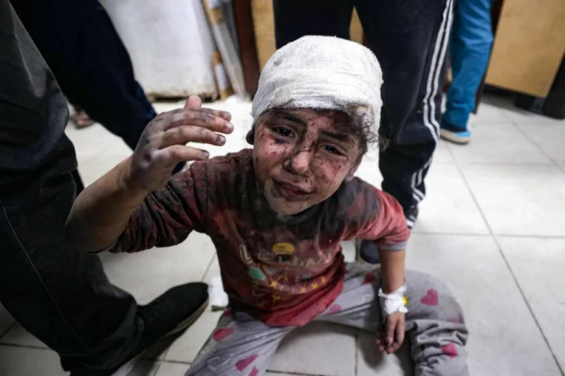 A young girl injured in Israeli bombardment, reacts as she sits on the floor at the al-Najjar hospital in Rafah in the southern Gaza Strip on Sunday. AFP