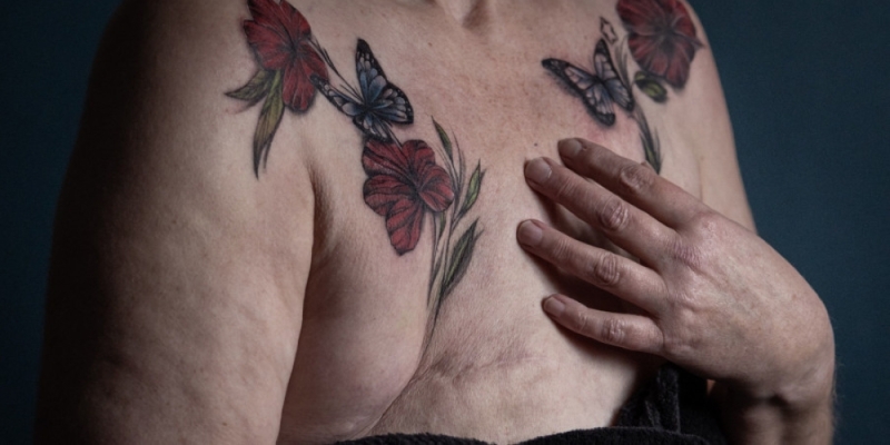 Free tattoos give hope for Dutch breast cancer survivors