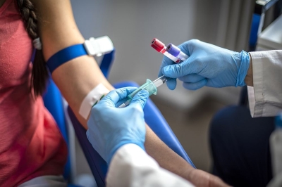 Breast cancer: A new kind of blood test could predict relapse It may soon be possible to predict breast cancer relapse. ― Pixel_away /IStock.com pic via AFP