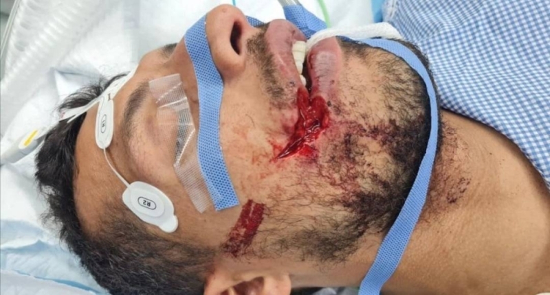 شاهد.. أول صورة للإصابة القوية التي تعرض لها لاعب الاتحاد طارق حامد أمام الصفاقسي التونسي