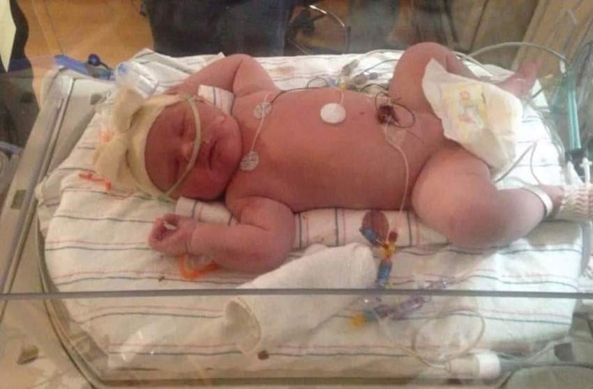 ولادة طفلة تزن 6.8 كيلوغرام في نيويورك