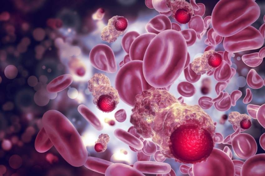 خبراء في تايلاند يعلنون عن نتائج إيجابية لعلاج سرطان الدم بـ «الخلايا القاتلة»