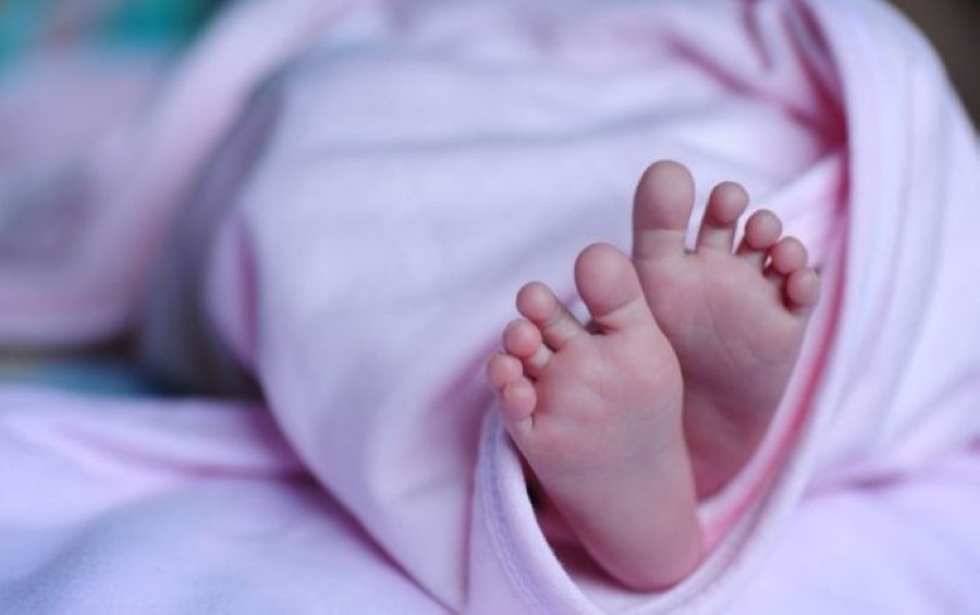 ولادة طفل من دون وجه تهز البرتغال