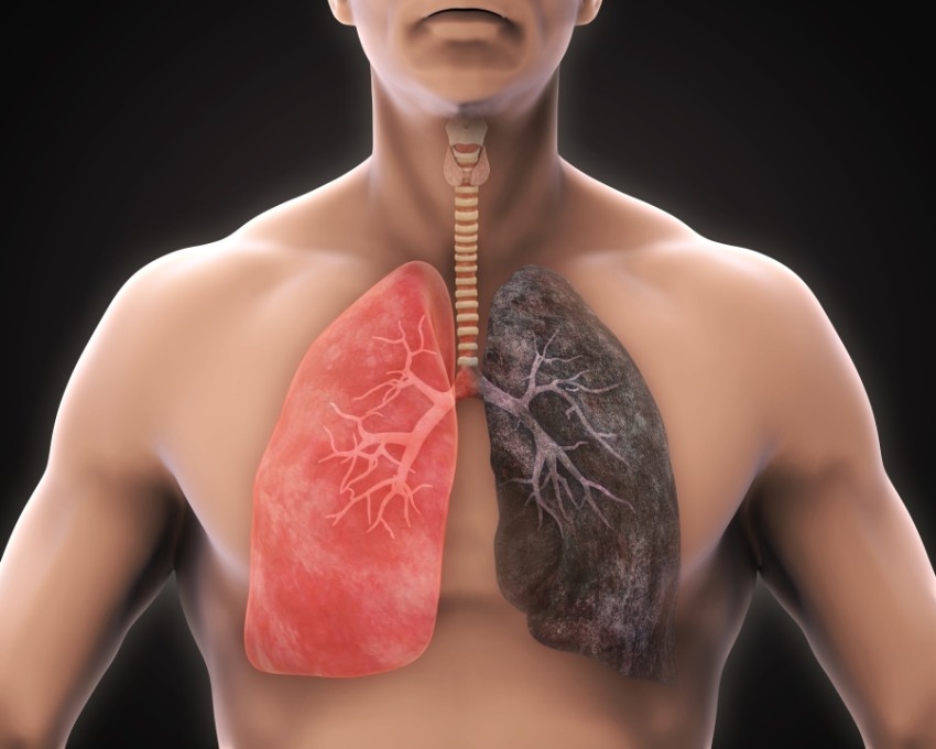 «صحة أبوظبي»: 5% من وفيات الإمارة بسبب أمراض الجهاز التنفسي