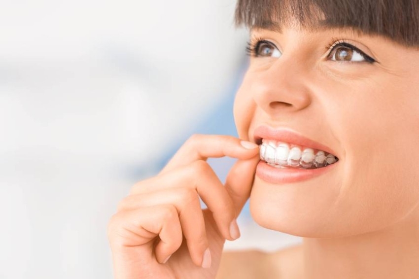 ماذا تعرف عن تقويم الأسنان الشفاف؟