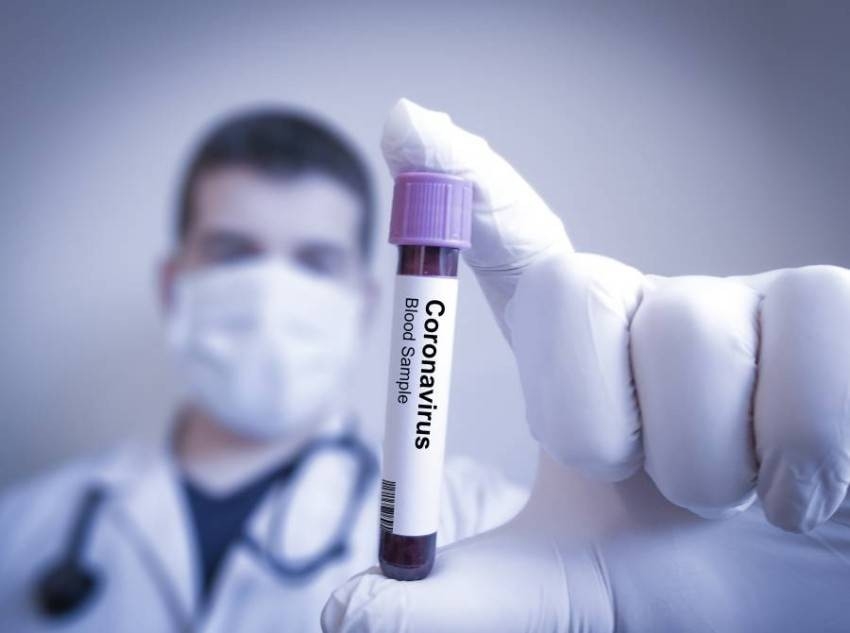 إيران تعلن تسجيل أول حالتي إصابة بفيروس كورونا