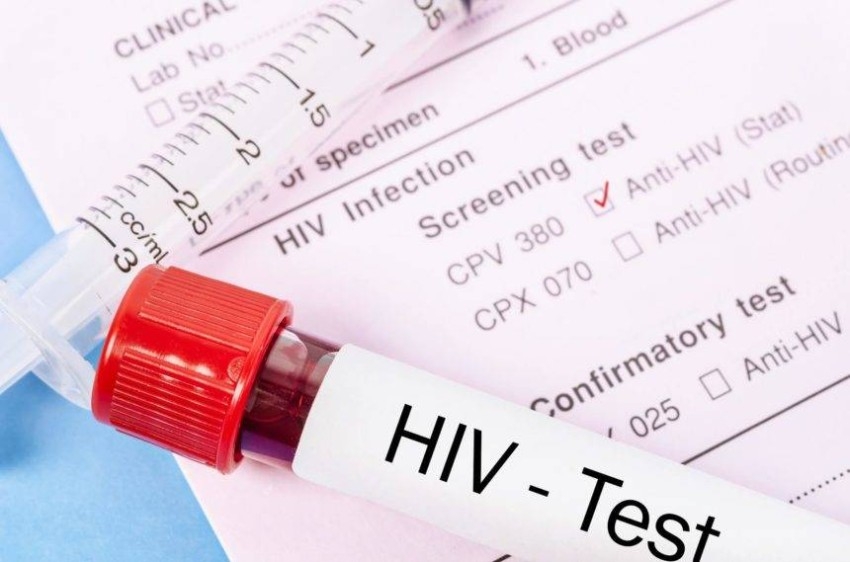 الأمم المتحدة تحذر من انتكاسة جهود مكافحة الإيدز بسبب كورونا