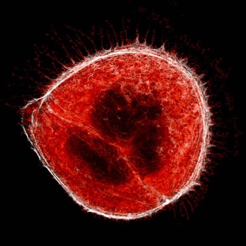 كيف تساعد الخلايا المصابة في نشر فيروس كورونا؟
