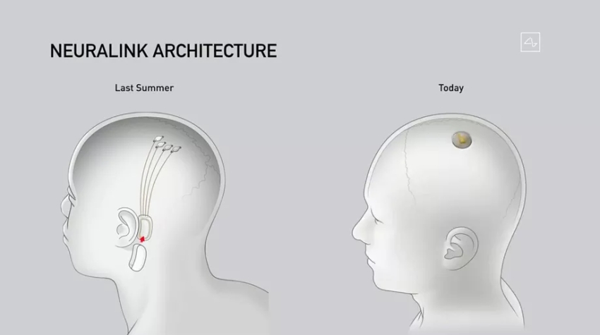 «إلون ماسك» يكشف عن تقنية جديدة لزرع الأجهزة في الدماغ
