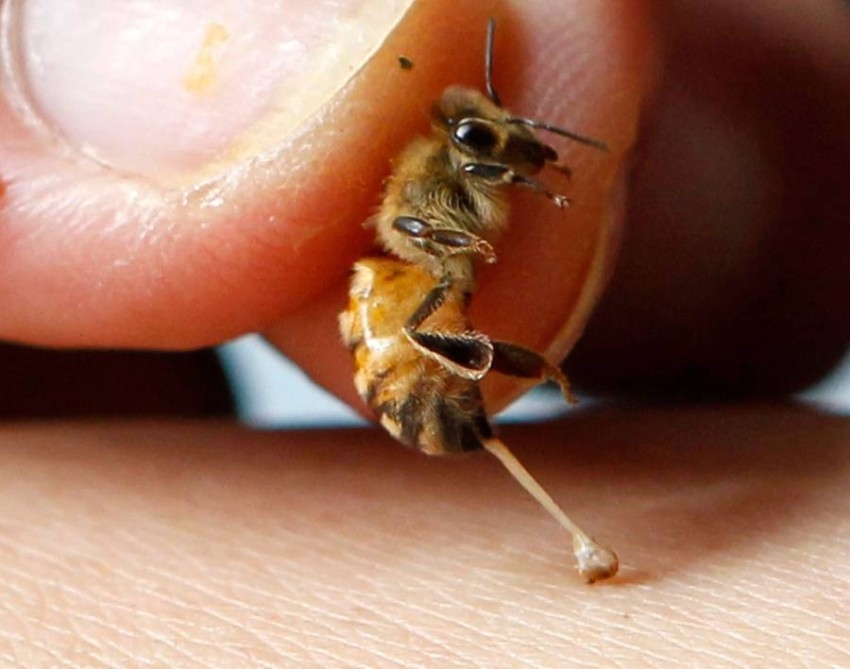 دراسة: سم نحل العسل يقتل خلايا سرطان الثدي