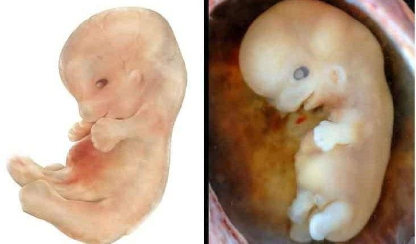 صور.. مراحل نمو الجنين خلال 40 أسبوعاً
