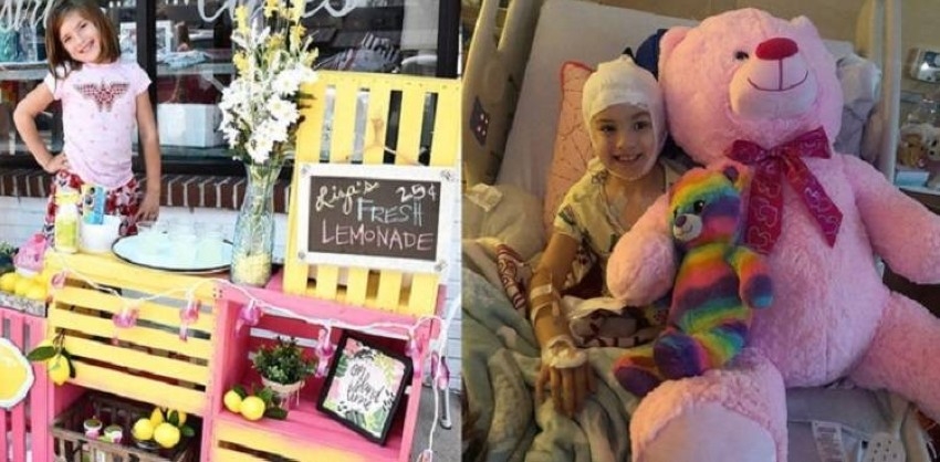 طفلة تبيع عصير الليمون للعلاج من تشوهات الدماغ