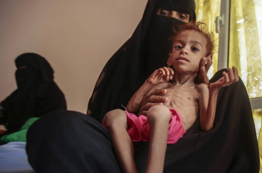 مؤتمر أممي يعتزم الدعوة لتمويل إنقاذ المتضررين من حرب اليمن