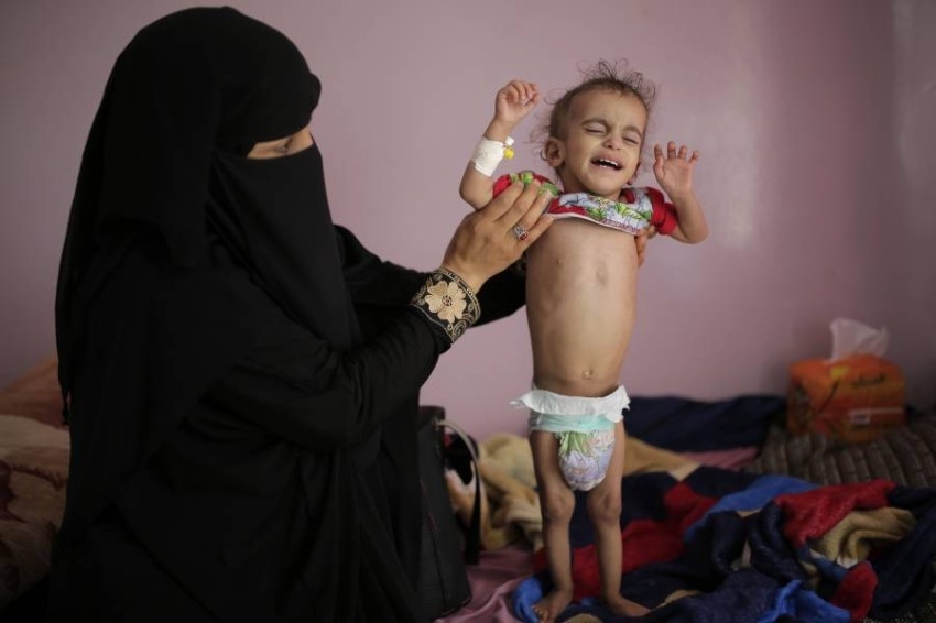 وسط تراجع المساعدات الغربية.. الأمم المتحدة تحذر من أوضاع خطيرة لأطفال اليمن