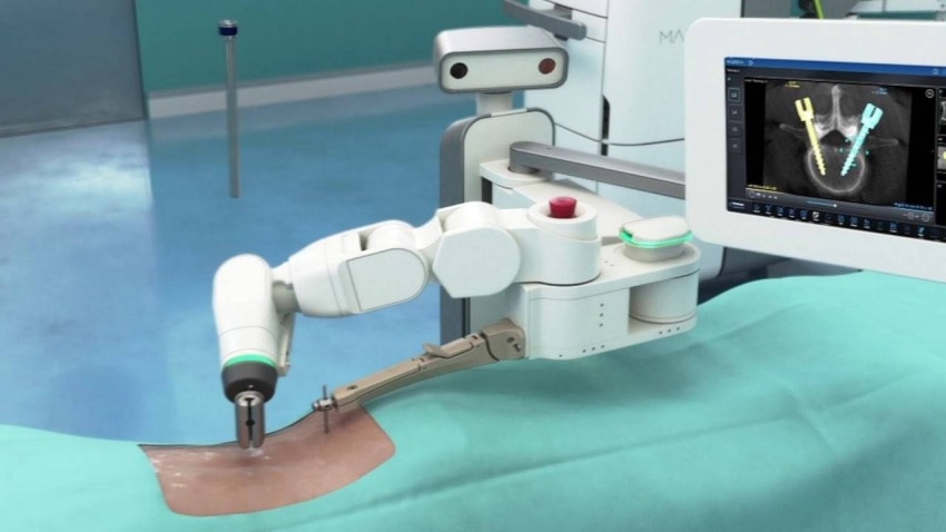 «ذراع روبوتية» تساعد الجراحين في غرفة العمليات