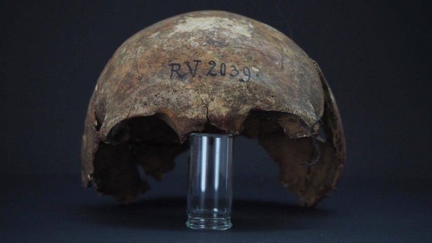 باحثون: أول ضحية للطاعون رجل عاش قبل 5000 سنة